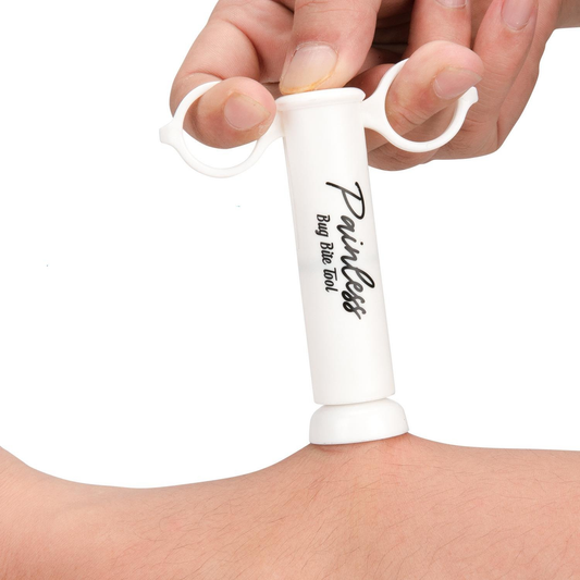 Portable Outdoor Natural Mosquito Bee Bites Chemical Free Bed Bug Bites Suction Removal Toxin Relief Pain Itching and Swelling